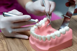How Dental Crowns Restore Damaged or Weakened Teeth